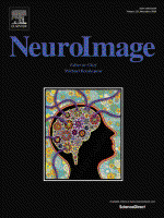 The developing Human Connectome Project (dHCP) automated resting-state functional processing framework for newborn infants